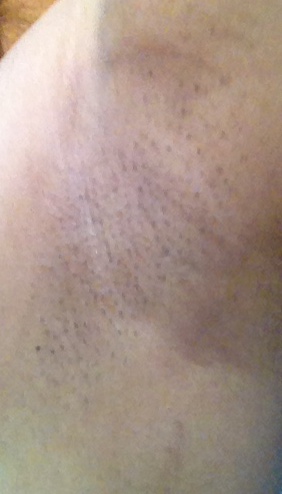 This is how my armpit looked when I shaved on every second day.  The regrowth is noticeable and rough to the touch.